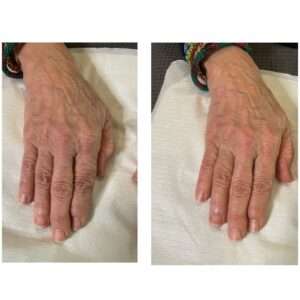 L'hiver pour les soins esthétques